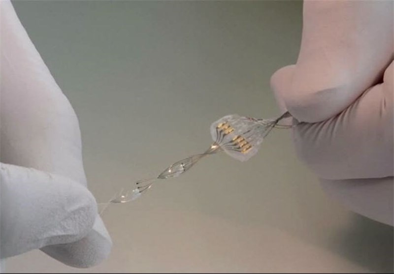 طرح ملی بیوایمپلنت آماده بهره برداری – جمهورآنلاین